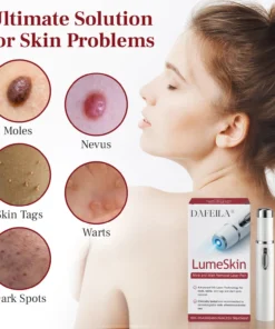 DAFEILA® LumeSkin Mole and Wart Removal Laser Pen