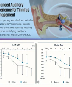 Dafeila™ SoniPulse Tinnitus Relief Soothing Aid
