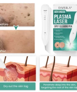 Dafeila® Advanced Plasma Laser Spot Cleaning Pen