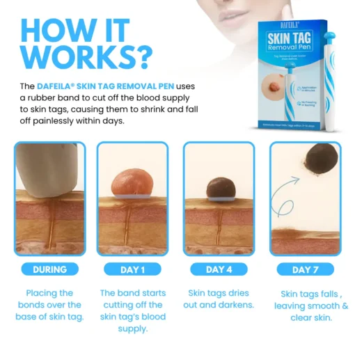 Dafeila® Skin Tag Removal Pen