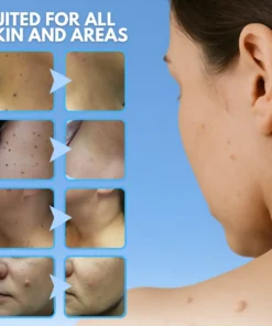 Dafeila® Skin Tag Removal Pen