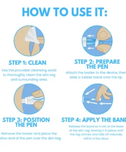 Dafeila® Skin Tag Removal Pen