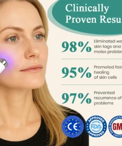 DAFEILA® LumeSkin Mole and Wart Instant Removal Laser Pen 4