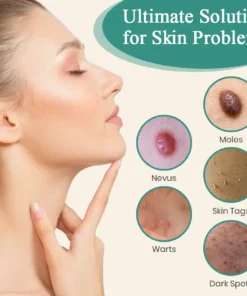 DAFEILA® LumeSkin Mole and Wart Instant Removal Laser Pen 4