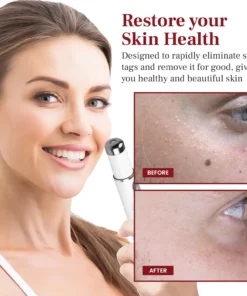 DAFEILA® LumeSkin Mole and Wart Removal Laser PenUltra02