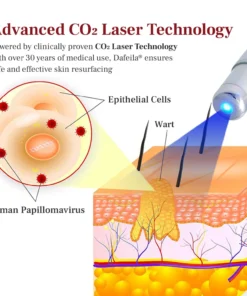 DAFEILA® LumeSkin Mole and Wart Removal Laser PenUltra03