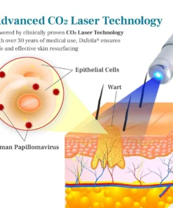 DAFEILA® LumeSkin Mole and Wart Removal Laser PenUltra04