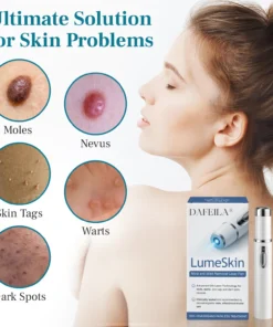 DAFEILA® LumeSkin Mole and Wart Removal Laser PenUltra04